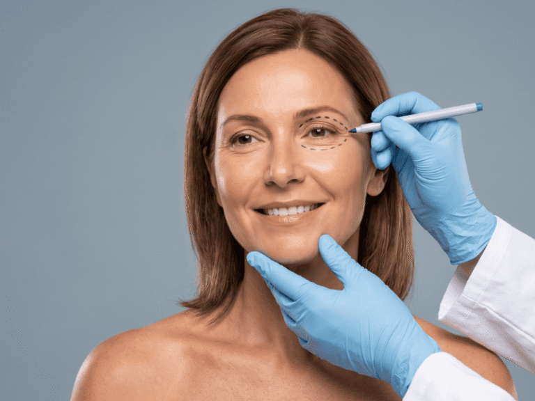 chirurgie paupieres aveyron
